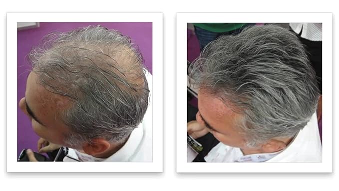 Caboki Hair Loss Concealer, 90-day supply, Dark Gray