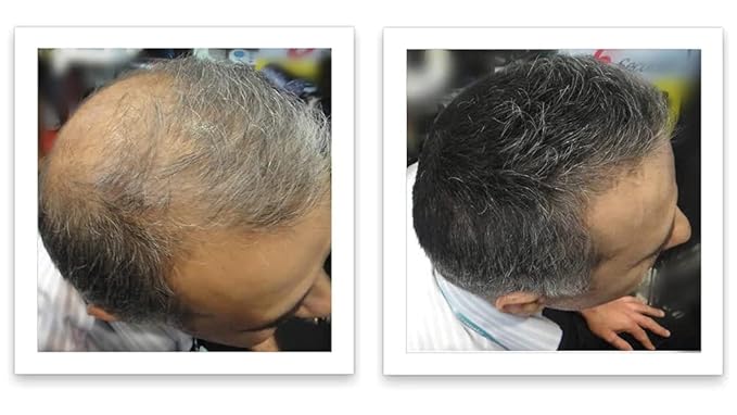Caboki Hair Loss Concealer, 90-day supply, Dark Gray