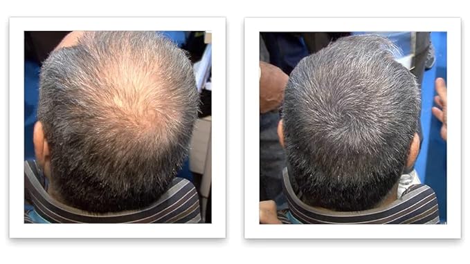 Caboki Hair Loss Concealer, 90-day supply, Dark Gray