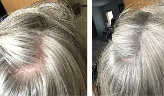 Caboki Hair Loss Concealer. All-Natural Hair Building Fiber. Make Thin Hair Look 10X Fuller Instantly. Eliminate the Appearance of Bald Spot and Thinning Hair (30G, 90-Day Supply). Gray