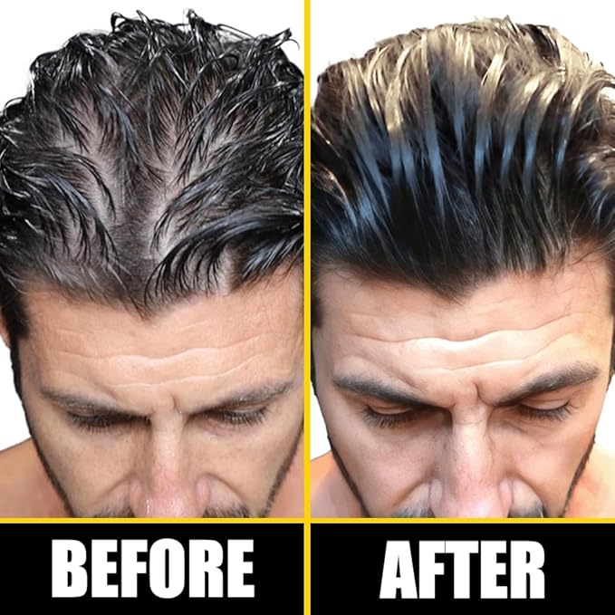 Pete & Pedro BOOST Hair & Beard Growth Serum Strengthening Oil For Men & Women - With Rosemary, Biotin & 20+ Natural Essential Oils | Shark Tank Featured, 2 oz.