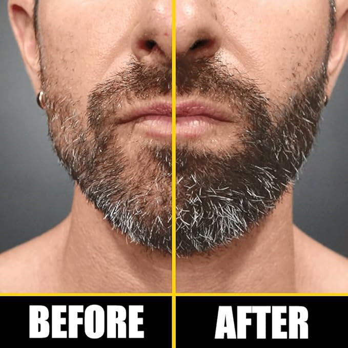 Pete & Pedro BOOST Hair & Beard Growth Serum Strengthening Oil For Men & Women - With Rosemary, Biotin & 20+ Natural Essential Oils | Shark Tank Featured, 2 oz.