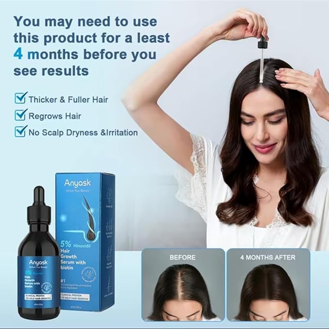 Anyash 5% Minoxidil Hair Growth Oil For Men and Women, Biotin Infused Serum For Hair Regrowth and Thinning, Natural Treatment for Thicker, Longer, Fuller, Healthier Hair, 60ml