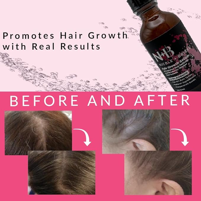 N+B Hair Growth Serum - Helps Promote Thicker, Fuller, & Healthier Hair w/Biotin, Natural-Based Formula, Helps Prevent Hair Fall & Thinning, For Women In All Hair Types - (2oz.) (3-Pack)