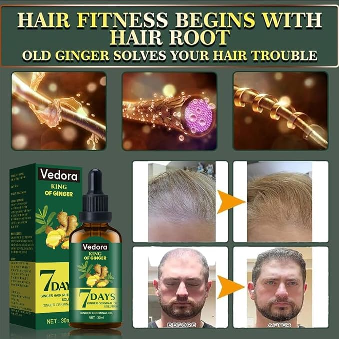 Vedora Ginger Oil for Hair Growth - Biotin Hair Growth Serum, 100% Pure Natural Ginger Essential Oil - Promotes Stronger, Thicker, Longer Hair in Women & Men - 3.0 Fl Oz / 90ML (3pc+Roller)
