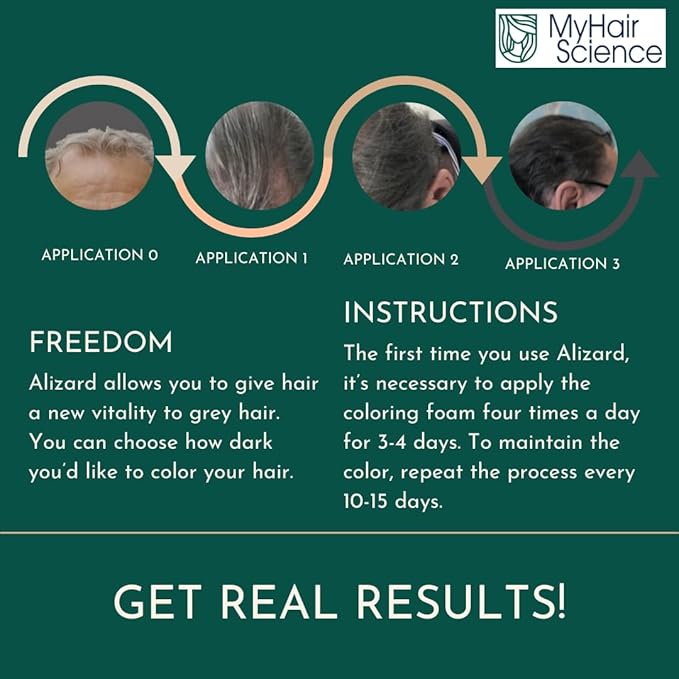 Alizard Natural Hair Color for Gray Hair | Gradual De-Graying Shampoo | Hydrolyzed Collagen & Allatonin | Not Hair Dye - Color Activation | Grey Hair Touch Up | Men & Women | Instant Results - Brown