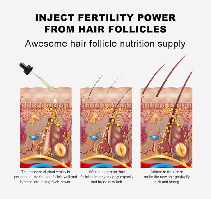 Vedora Ginger Oil for Hair Growth - Biotin Hair Growth Serum, 100% Pure Natural Ginger Essential Oil - Promotes Stronger, Thicker, Longer Hair in Women & Men - 1.05 Fl Oz / 30ML (1PC)