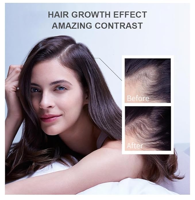 Vedora Ginger Oil for Hair Growth alongwith Roller - Hair Growth Serum, 100% Pure Natural Ginger Essential Oil - Promotes Strong, Thick, Long Hair in Women & Men - 5.05 Fl Oz / 150ML (5 PCS+Roller)