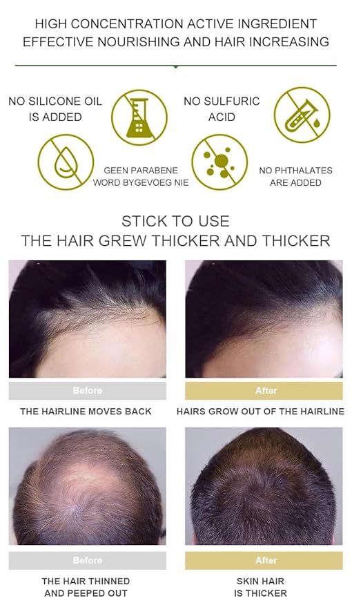 Vedora Ginger Oil for Hair Growth - Biotin Hair Growth Serum, 100% Pure Natural Ginger Essential Oil - Promotes Stronger, Thicker, Longer Hair in Women & Men - 1.05 Fl Oz / 30ML (1PC)