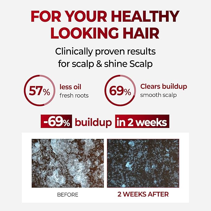 KUNDAL Anti Hair Loss Shampoo with Caffeine – Scalp Revitalizing for Thinning & Volumizing & root Strengthening – Sulfate-Free Korean Hair Care, White Musk, 16.9 fl oz (500ml)
