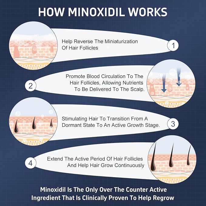 4 Packs Minoxidil Foam, 5% Minoxidil for Men and Women, Infused with Biotin, Hair Growth Treatment, Supports Thicker and Fuller Hair & Beard, Upgraded version (Minoxidil Foam 8.44Oz, 4-Month Supply)