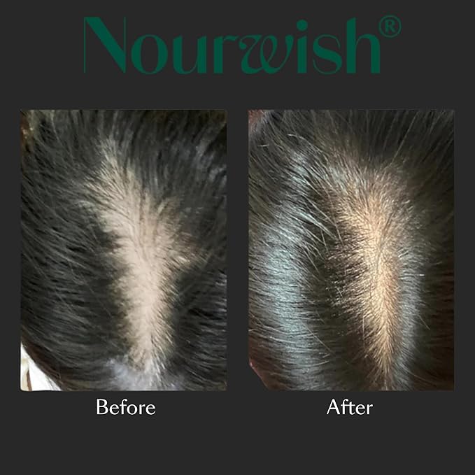 Hair Serum | Asian Haircare Hydrates & Supports Thicker & Stronger Hair | Rosemary, Niacinamide, Peppermint Oil | (Korean, Japanese) Hair Support (59ml)