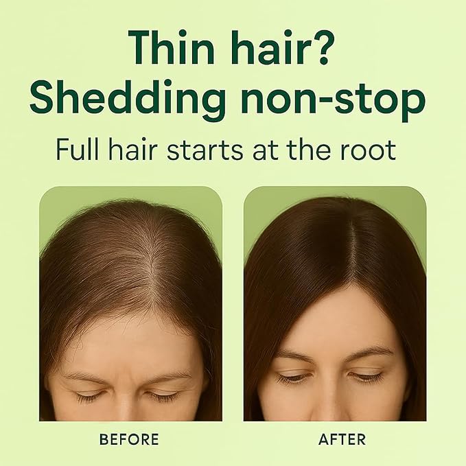 LUSTEL Rosemary Strengthening Volumizing Shampoo and Conditioner Set for Thinning Hair - Sulfate Free - Biotin Shampoo with Tea Tree & Mint. For All Hair Types - 16 Fl Oz Each (2-Pack)