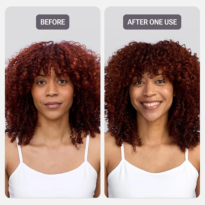 NULASTIN Strength & Shine Hair Duo – Vibrant Scalp Conditioner (10 fl oz) & Rejuvenating Hair Serum (1 fl oz) – Reduce Frizz, Enhance Volume, and Support Hair Growth (2 Pc)