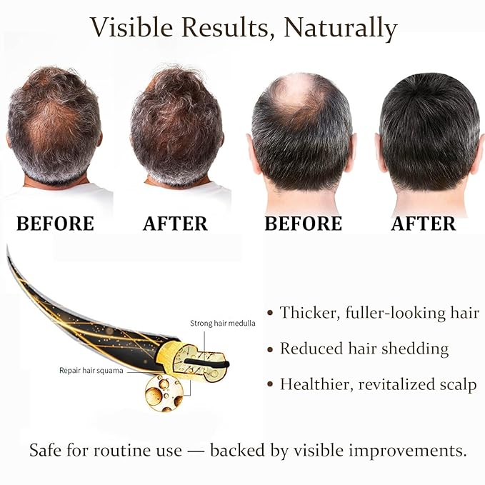 Hair Regrowth System – Advanced Hair Growth Treatment with Ginseng, Eclipta Prostrata, Peppermint Oil & Ginger Root, Thickening Serum for Men & Women (1)