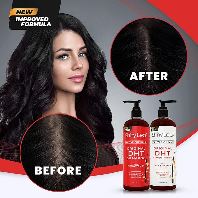 DHT Blocker Shampoo and Conditioner for Hair Loss With Biotin For Men, Women, Anti-Hair Loss Treatment, Rosemary Leaf Oil and Asparagus Extracts, for Thinning Hair (Shampoo and Conditioner) (1 Set)