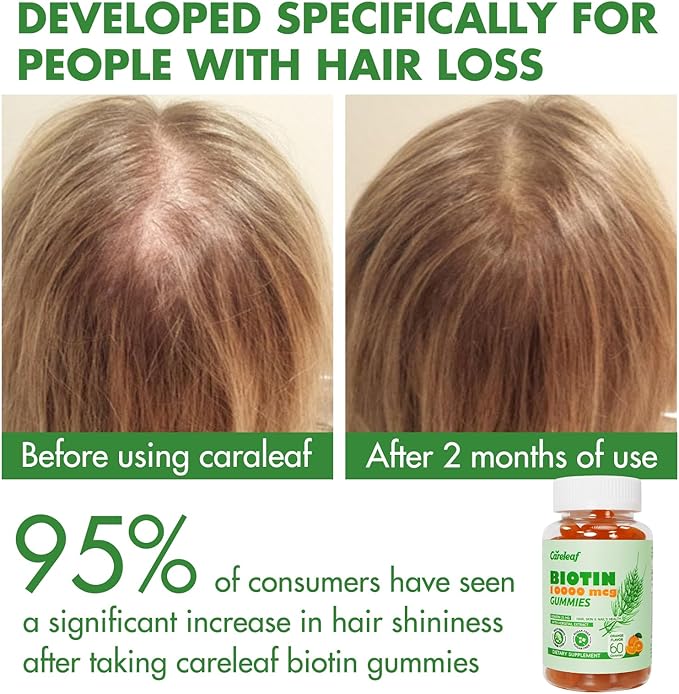 Biotin Gummies, Hair Growth Gummies with 10000 mcg Biotin/Collagen/Keratin, Hair Vitamins for Fuller Hair, Stronger Nails, Glowing Skin, Beauty Support for Women, 60 Count, Orange Flavor