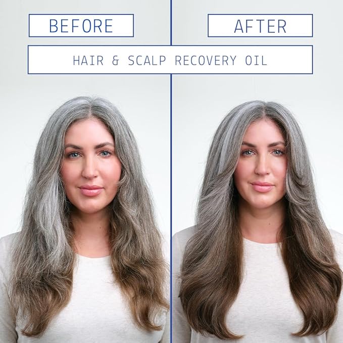 AAVRANI Mini Strengthening Hair Oil & Hair Growth Scalp Serum Gift Set - With Turmeric & Rosemary for Fuller Hair - Vegan, Travel Size