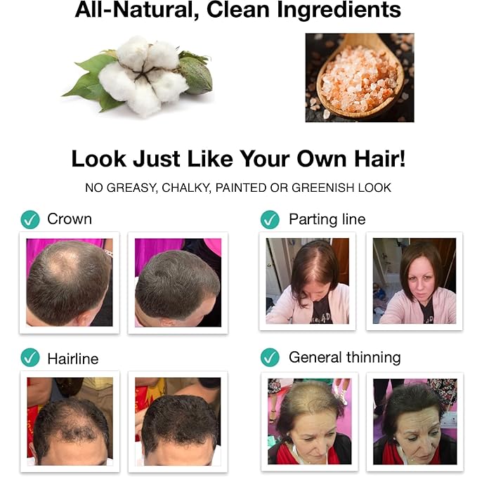 Caboki Hair Loss Concealer. All-Natural, Plant-Based Hair Building Fiber. Covers Bald Spot and Thinning Hair. Makes Thin Hair Look 10X Fuller Instantly (30G, 90-Day Supply). Natural Blonde