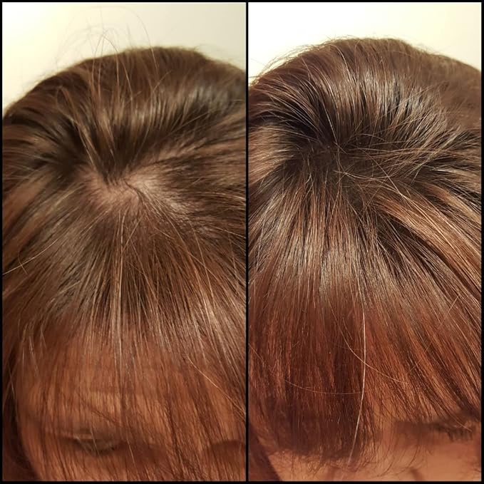 Caboki Hair Building Fiber. (30G, 90-Day Supply). Auburn