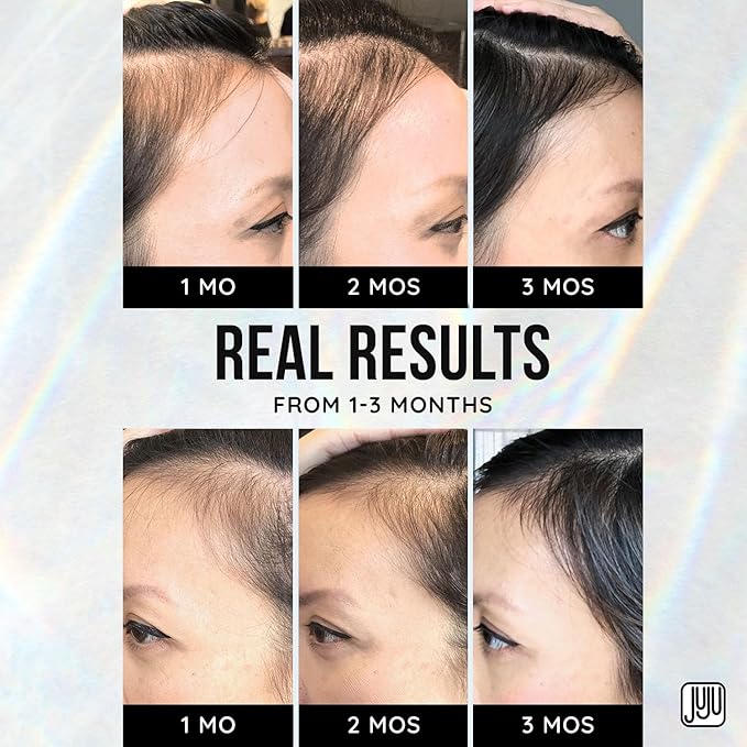 Renovo Biotin Hair Growth Serum - 1 Fl Oz Biotin Oil for Hair Growth for Women and Men, Fragrance-Free Scalp Oil Natural Hairline Enhancer for Men and Women, Scalp Serum for All Types of Hairs