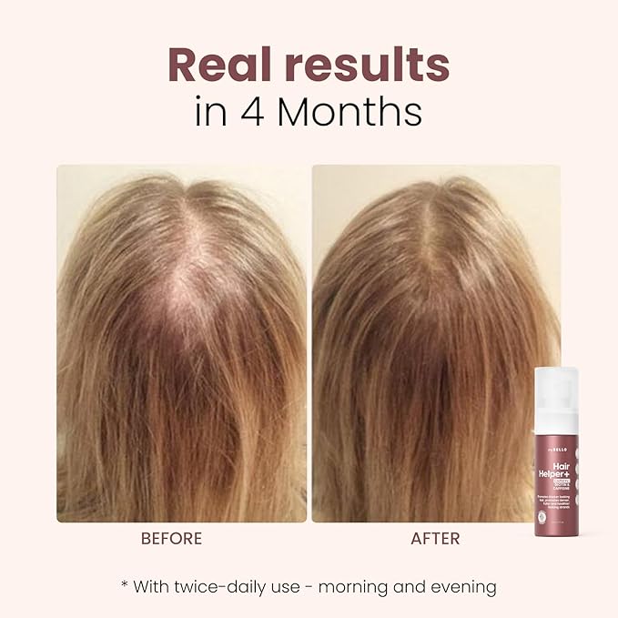 Hair Helper+ Spray - Growth Serum With Biotin & Castor Oil made in USA - Caffeine Infused Treatment for Thicker, Fuller Hair - Repair Thinning Naturally - Vegan, Cruelty-Free Formula