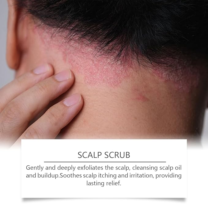 Avocado Oil Scalp Scrub, Rich in Grapefruit Extract, Grapeseed Extract, and Pumice, Natural Exfoliating Scrub & Dry Scalp, Gluten Free, Vegan, 5.29OZ