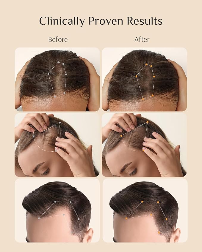 DR ZERO Hair Growth Conditioner for Women, Japanese Hair Care, 13.5 oz, Volumize Thickening, Hydrate Damaged Hair and Scalp, Sulfate & Silicone-Free, Redensyl® Combine Nano-Tech Improves Thinning