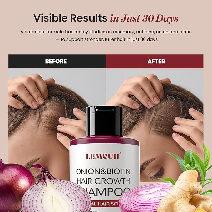 Onion & Biotin Hair Growth Shampoo: Infused With Natural Rosemary Tea Tree Oil Anti Hair Loss Treatment - Scalp Smooths Thickening Formula Support Hair Regrowth For Women Men 12.5Fl Oz
