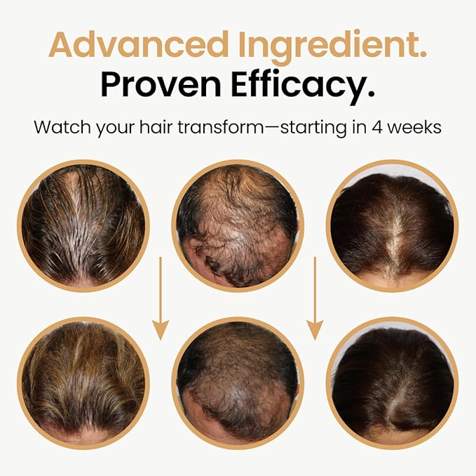 Hair Booster for Women & Men – Hair Revitalizing Serum with Capilia Longa & Arginine for Thick, Dry, Long, Damaged Hair – Peptide-Enriched Hair Tonic, 2 Fl Oz