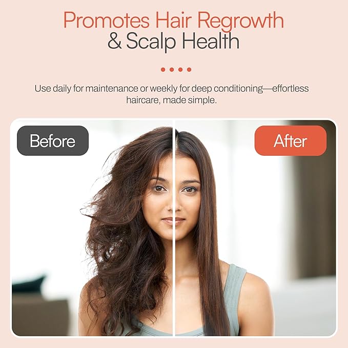 Foltene | Hair Beautifier Conditioner without Sulfate or Silicone | Vitamin E-Rich Beauty Product for Smooth, Shiny Strands | Anti-Aging Panthenol & Macadamia Oil Formula | Moisturise Dry Hair