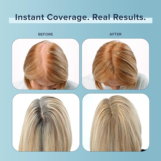 TRUHAIR Color Fibers Root Coverage & Density Booster | Quick-Apply Root Touch Up Hair Color | Natural Color Matching, Gray Hair Cover up to Color Gray Roots - 11 Hair Colors Available (Red)