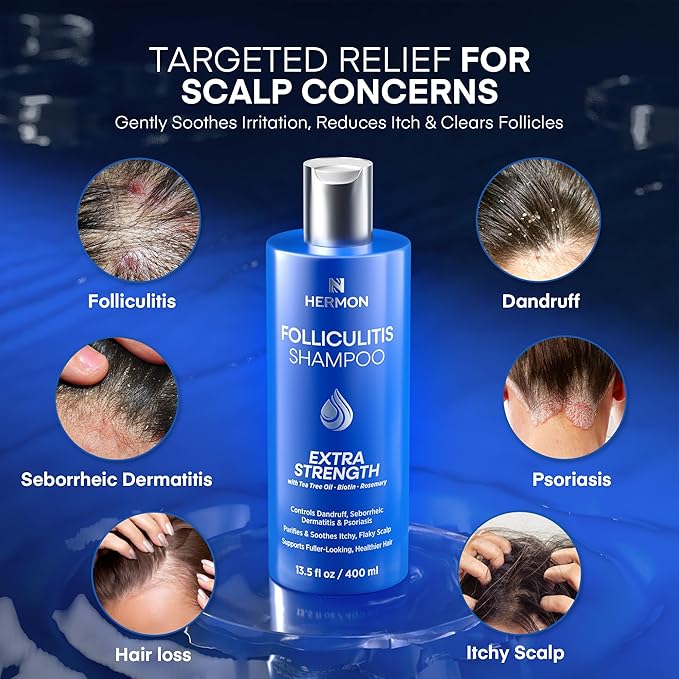 Hermon Folliculitis Shampoo for Itchy Scalp: Psoriasis, Dandruff & Seborrheic Dermatitis & Biotin – Soothes | Exfoliates | Reactivates Follicles