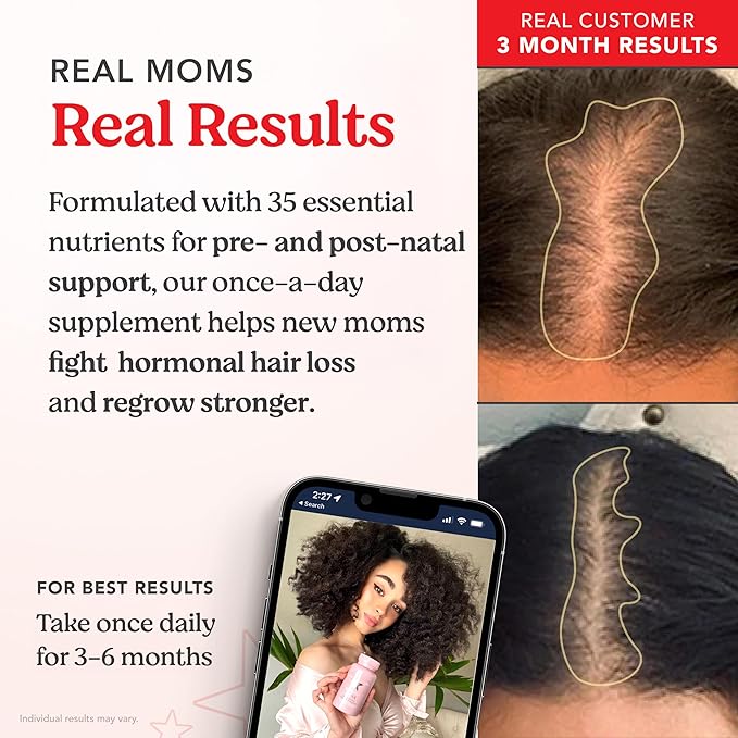 HAIRtamin MOM Vegan Prenatal & Postnatal Multivitamin Supplement & Hair Vitamin Pregnancy, Postpartum, Breastfeeding Probiotic One-a-Day Hair Vitamins with Biotin, Zinc, Iron (30 Counts)
