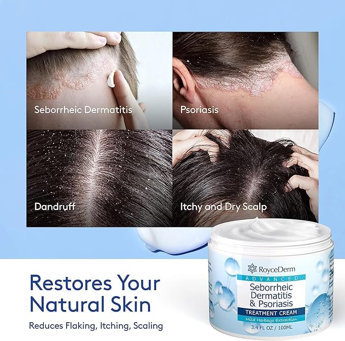 Roycederm Seborrheic Dermatitis Cream, Scalp Treatment for Psoriasis, Folliculitis, Dry Scalp, Dandruff, Anti-Itch Cream for Soothing Relief - 2 Pack