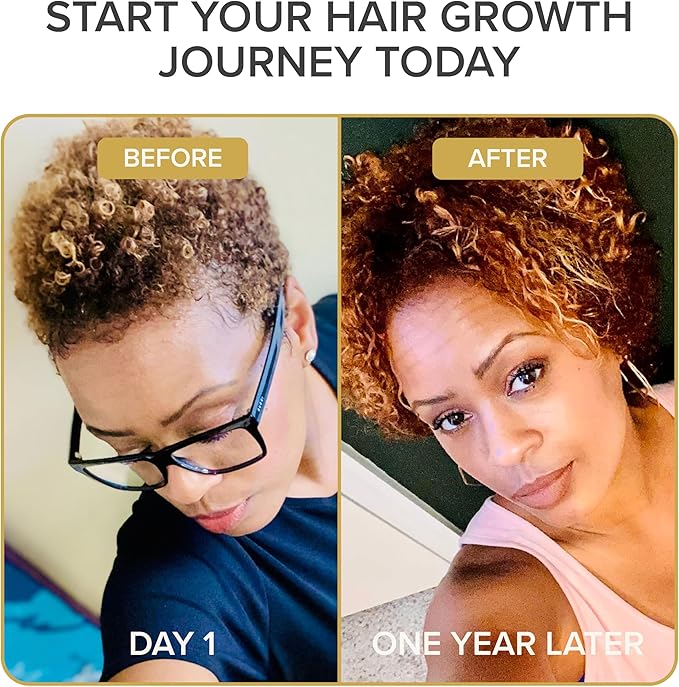 Iconic Natural Hair Vitamins for Fast Hair Growth, Pure Hair Supplements Formulated with Vitamins to Promote Thicker, Stronger Hair - Vegan Hair Care for Hair Loss - (60 Capsules(Pack of 1))
