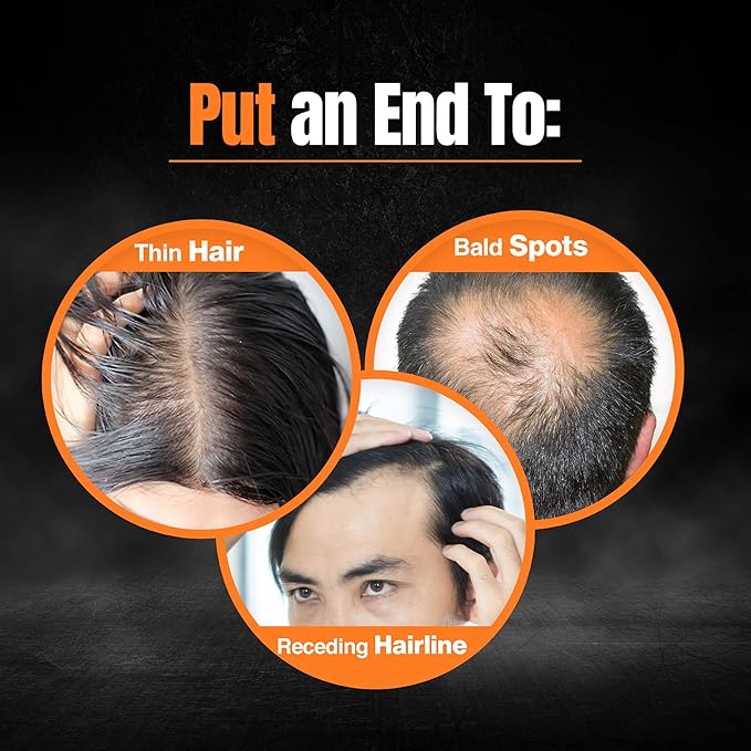 Nourish Mantra Advanced Hair Growth Serum 50ml, 3% Redensyl, 2% Anagain, 2% Procapil, 5% Rice Water, Promotes Hair Regrowth, Anti Thinning & Hair Loss Treatment,Rapid Hair Growth Serum for Women & Men