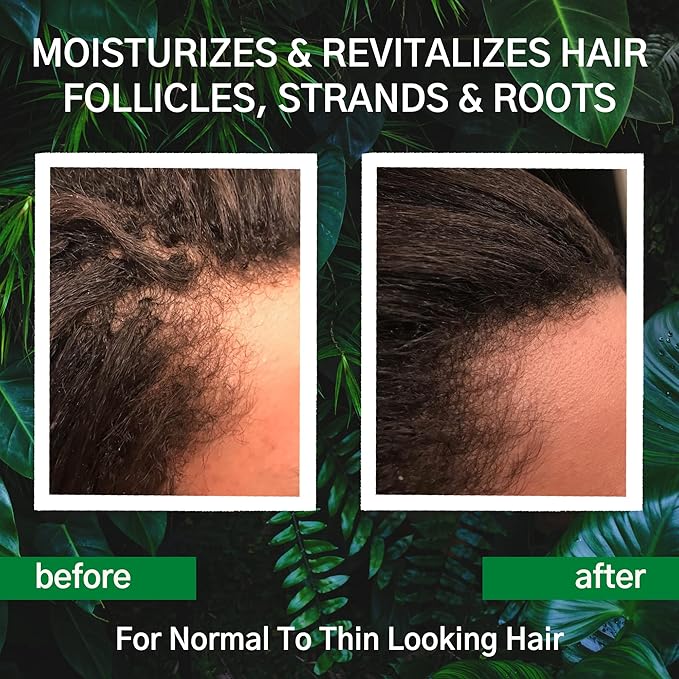 Hair Growth Conditioner - Hair Loss Conditioner For Thinning Hair - Sulfate Free Prevention Formula Against Hair Loss, Alopecia & Receding Hairline with Argan Oil - by Amplixin