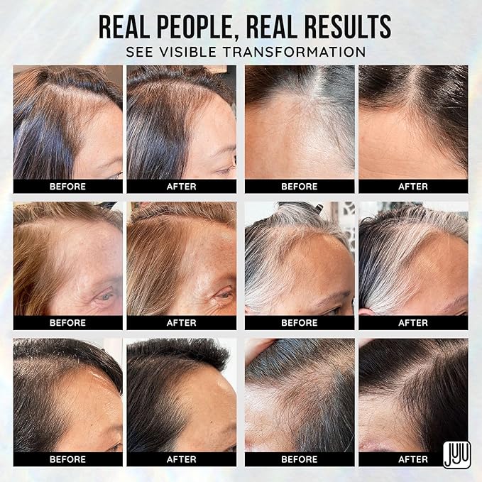 Renovo Biotin Hair Growth Serum - 1 Fl Oz Biotin Oil for Hair Growth for Women and Men, Fragrance-Free Scalp Oil Natural Hairline Enhancer for Men and Women, Scalp Serum for All Types of Hairs
