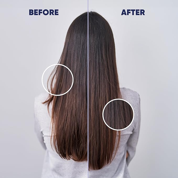 MOERIE Ultimate Hair Growth Serum for Natural Hair Regrowth & Thickening - Anti Thinning & Hair Loss Treatment for Women - Rapid Hair Growth Products - Scalp Oil Alternative - 1.69 fl oz / 50 ml