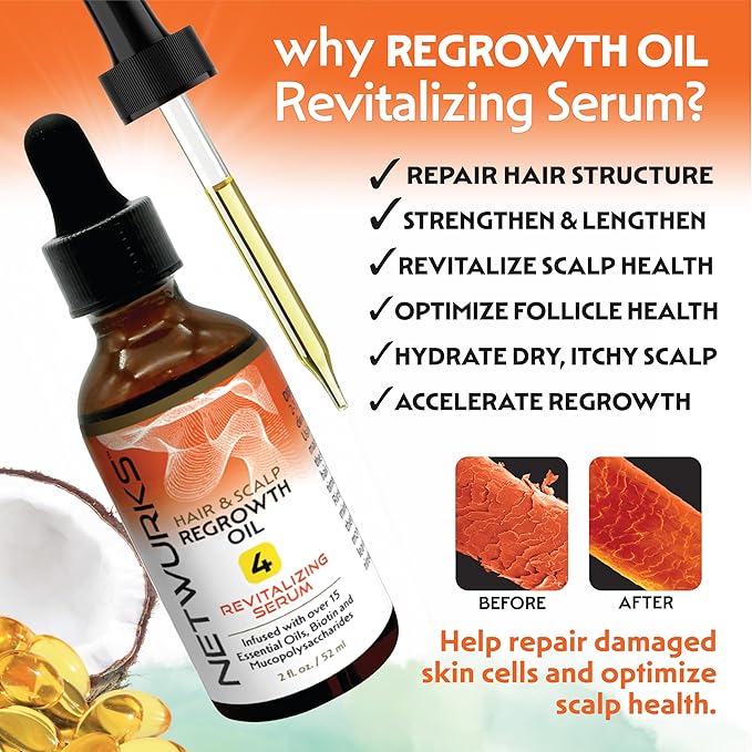 Hair & Scalp Regrowth Oil, Pure Rosemary, Coconut Oil, Biotin & Mucopolysaccharides, (polysaccharide/sugar polymer), Repairs & Promotes Hair Growth, Revitalizing Serum, 2 oz