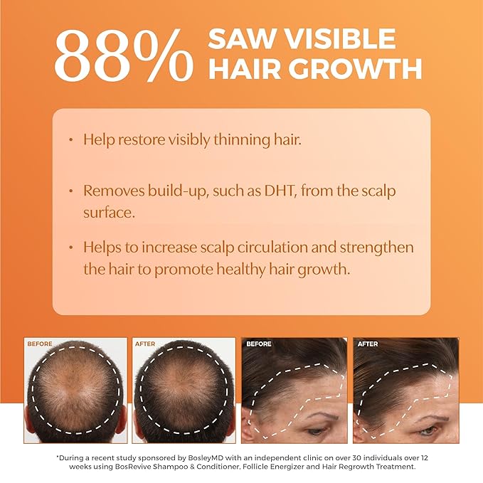 BosRevive Nourishing Shampoo for Noticeably Thinning Hair (Color Safe) – DHT Blocker, Sulfate-Free, Vegan Formula with Biotin, Saw Palmetto & Rosemary – Strengthens & Volumizes – 10.1 Fl Oz