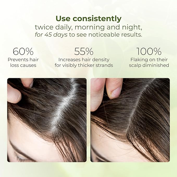 Cocoon Pomelo Oil Hair Tonic. 100% Vegan Scalp Serum Treatment for Thinning, Damaged & Breakage Hair | Soften, Reduce Hair Loss & Promote Hair Growth. 10.5 fl oz