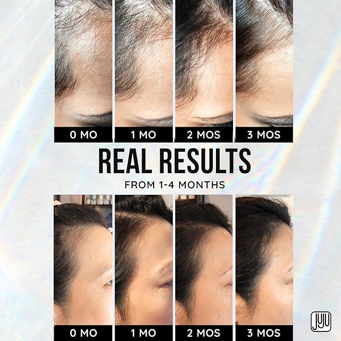 Renovo Biotin Hair Growth Serum - 1 Fl Oz Biotin Oil for Hair Growth for Women and Men, Fragrance-Free Scalp Oil Natural Hairline Enhancer for Men and Women, Scalp Serum for All Types of Hairs