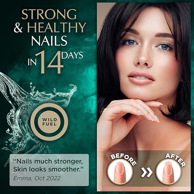 Liquid Collagen Peptides with Biotin Drops - 15,000mcg Collagen Liquid for Women and Men plus Biotin - Youthful Skin, Hair Growth, Strong Nails - Hair Vitamins for Hair Loss - Lemon Flavor - 2x2oz