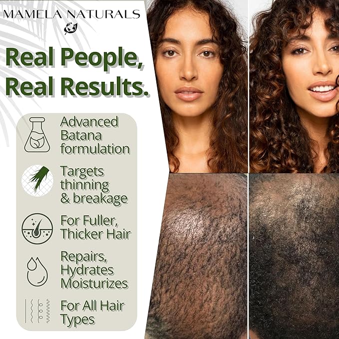 Batana Oil for Hair Growth - 100% Pure & Natural Blend with Raw & Organic Rosemary, Almond, Peppermint Oil - For Thicker, Fuller Hair - 2oz - All Hair Types