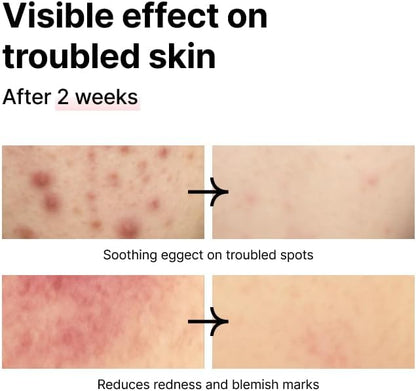 PINKWONDER Tamanu Hero Mineral Salt Essence Toner | All-in-One Blemish Solution | Instant Cooling & Redness Relief | Tamanu Oil & 70+ Minerals for Skin Balance (150ml / 5.07 fl. oz.)