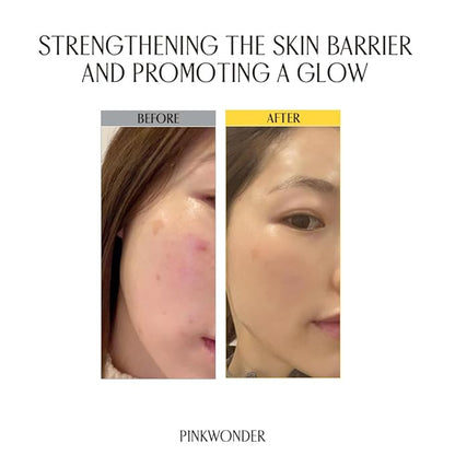 PINKWONDER Jojoba Vita Cream 3.38oz (100ml), Jojoba Oil and vitamin B12 Face Cream, Soothing for Sensitive Skin, Hypoallergenic, Korean Skincare