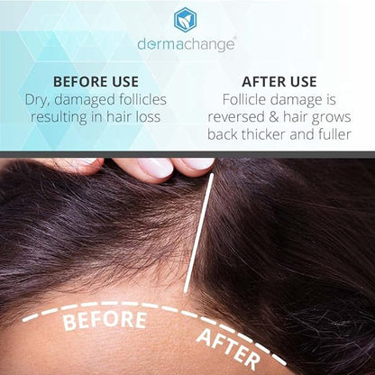 Hair Growth Shampoo for Thinning Hair and Hair Loss - Volumizing and Thickening Sulfate-Free Formula for Men and Women - Enhances Shine and Body for Color-Treated Hair with Aloe Vera (8oz)