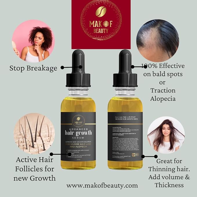 Effective Hair Growth Treatment: Biotin, Collagen, Protein and 38 Essential Oils for Longer, Thicker Hair. Moisturizes Scalp, Prevents Dandruff and Edges Loss. 60ML